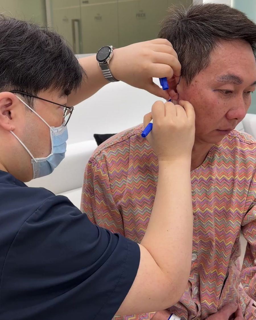 Men's Anti-aging before and after photo 2 — CYL Korea Surgery