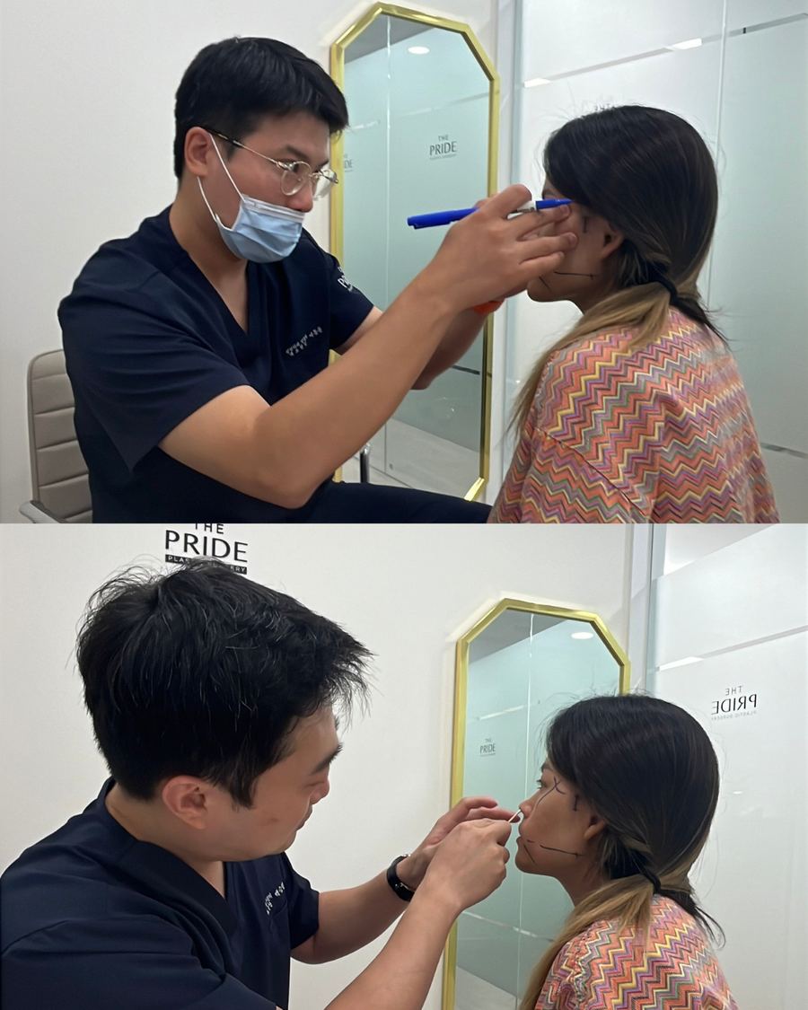 Facial Contouring & Rhinoplasty before and after photo 6 — CYL Korea Surgery