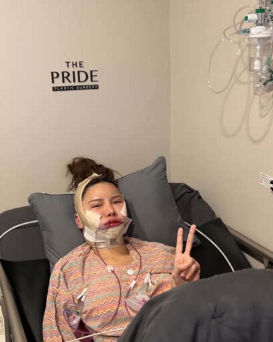Facial Contouring before and after photo 1 — CYL Korea Surgery