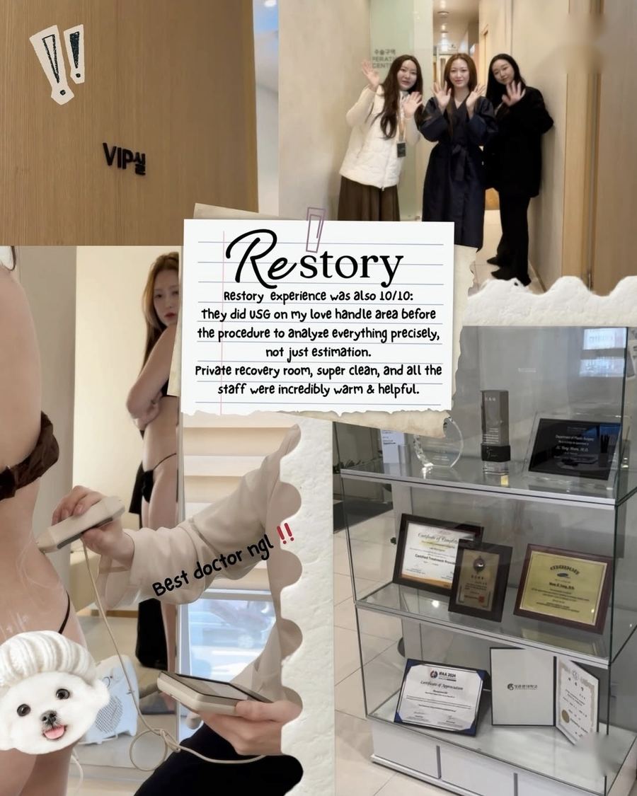 Body Liposuction before and after photo 5 — CYL Korea Surgery